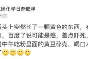 你有没有过这种经历