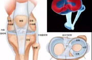 半月板损伤了，咋判断是不是轻伤呢？