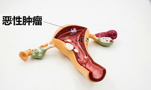 再婚又想离？到底多久才是合适的时间？