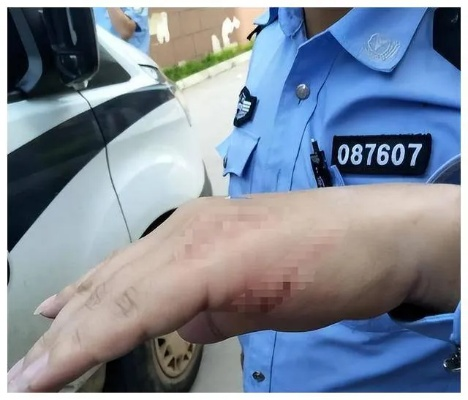 被人打成轻伤，警察会怎么处理？我该怎么办？