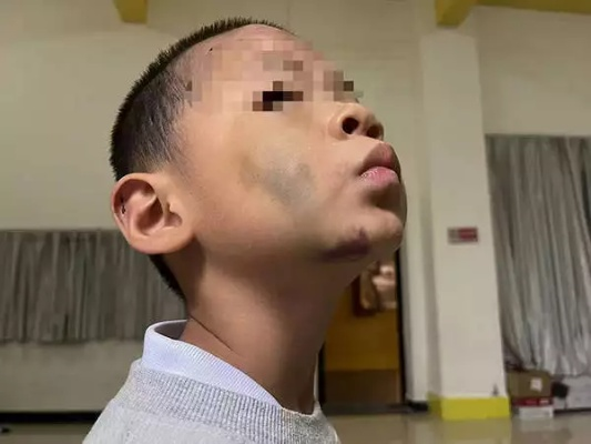 轻伤二级，对方兜里比脸还干净，咋办？