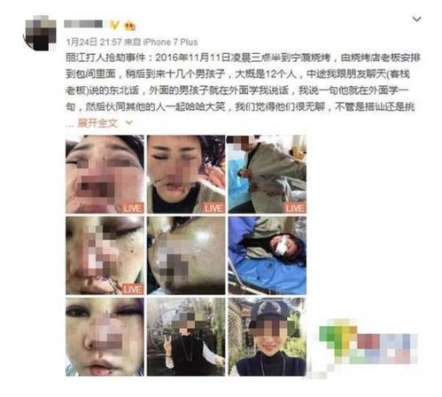 打架受伤了，轻伤到底是咋判断的？