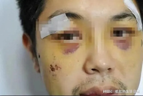 牙齿被打掉3颗算轻伤，会怎么判刑呢？