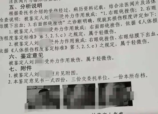 伤残鉴定里，轻伤到底是咋回事儿？