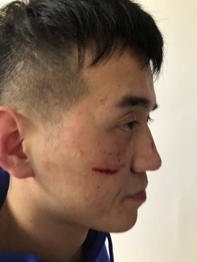 被雷劈成轻伤，我该找谁赔？能赔多少？