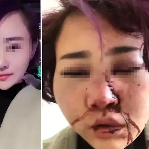 打架致对方轻伤二级，会怎么判刑？