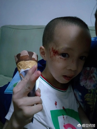 孩子脸磕了？儿童脸部轻伤怎么赔偿？家长别急，一步步来！