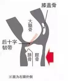 膝盖韧带损伤，咋才算轻伤？说了是轻伤，又能咋地？