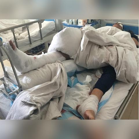 被人打致轻伤，赔偿该怎么算？能拿到多少？