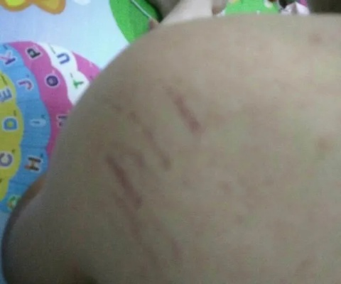 腿上被抓了几道印子，算不算轻伤？怎么判断？