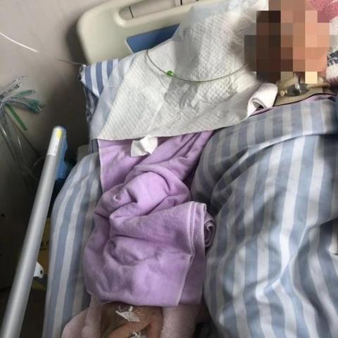 脸被打伤了？别慌！面部轻伤后这样处理最妥当，赔偿一步到位！
