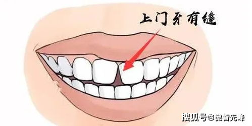 门牙磕掉半颗算轻伤吗？能赔多少钱？对方不赔怎么办？