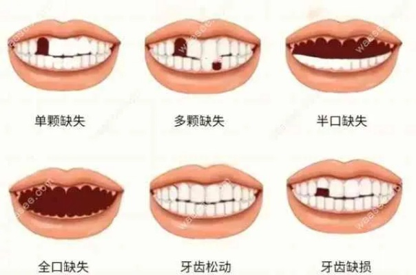 牙齿被打掉几颗算轻伤？会有啥法律后果？