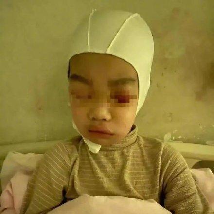 对方轻伤却没去治，赔偿怎么算？我能要哪些？