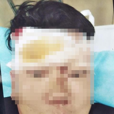 打架致轻伤，我只是个帮忙的，会有事吗？从犯该咋整？