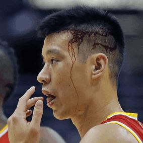 鼻子被打，到底啥样才算轻伤？够上轻伤能咋样？