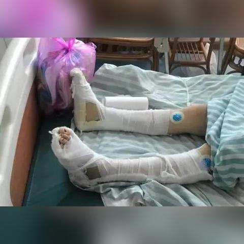 眼睛被打了？别急！教你怎么判断是不是轻伤