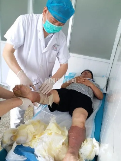 腹部烧伤咋才算轻伤？够不上轻伤又咋办？