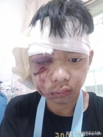 脸上挨了一刀，构成轻伤会怎么判？受害者该如何应对？