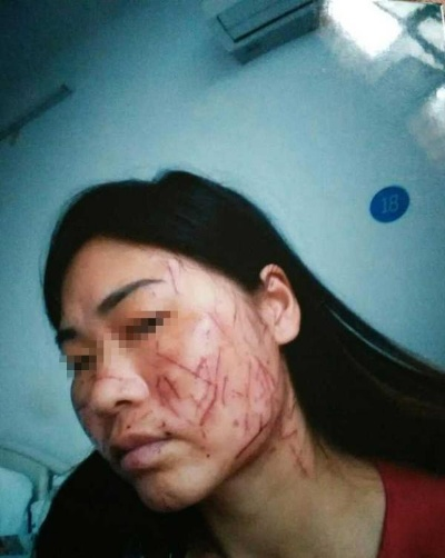 脸被打致轻伤？别急，教你一步步正确处理！