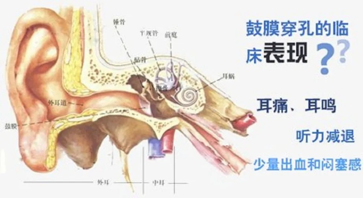 耳膜穿孔算轻伤吗？会怎么判刑？遇到了该怎么办？