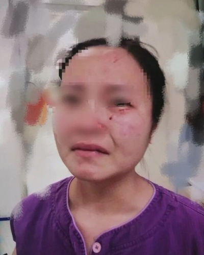 眼睛充血了算轻伤吗？法律上怎么界定？