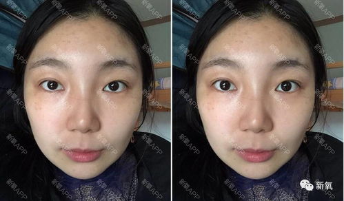 眼眶被打成轻伤了,赔偿该怎么算?能赔多少? 眼眶被打成轻伤了,赔偿该怎么算?能赔多少?
