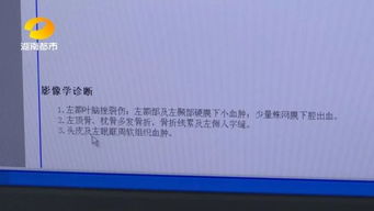 轻伤也分轻重？一级二级怎么看？