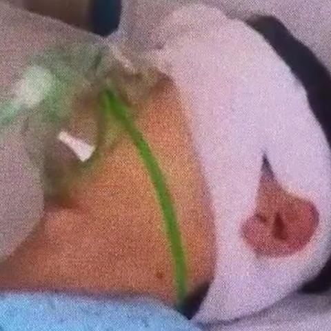 打架打出轻伤，赔偿的事儿该怎么了？钱怎么算？