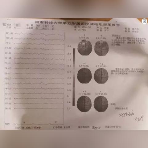 贷款一万元逾期被起诉?别慌!3步自救指南+律师亲授应对策略 贷款一万元逾期被起诉?别慌!3步自救指南+律师亲授应对策略
