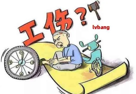 工伤都包括啥?出了事该咋办? 工伤都包括啥?出了事该咋办?