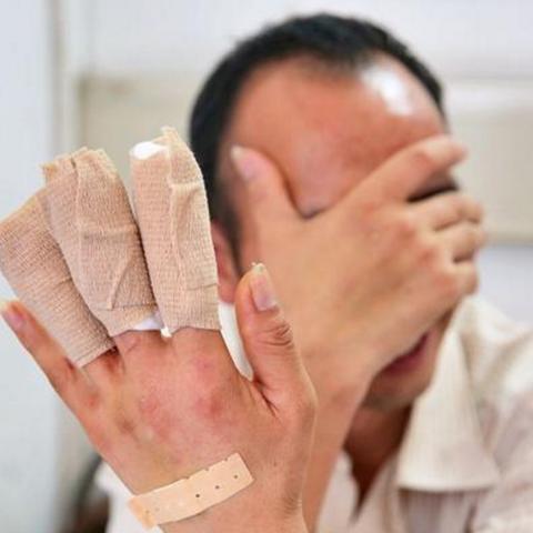 工伤了怎么申报？单位不配合咋办？