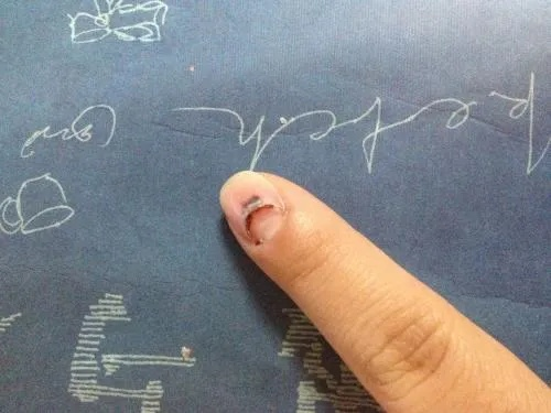 指甲盖儿被砸掉了算工伤吗?能评上几级? 指甲盖儿被砸掉了算工伤吗?能评上几级?