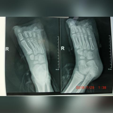 十级工伤到底能赔多少钱？赔偿标准和流程是怎样的？