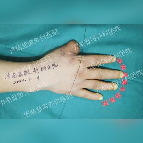 工伤了,去哪儿做伤残等级鉴定?对结果不满意怎么办? 工伤了,去哪儿做伤残等级鉴定?对结果不满意怎么办?