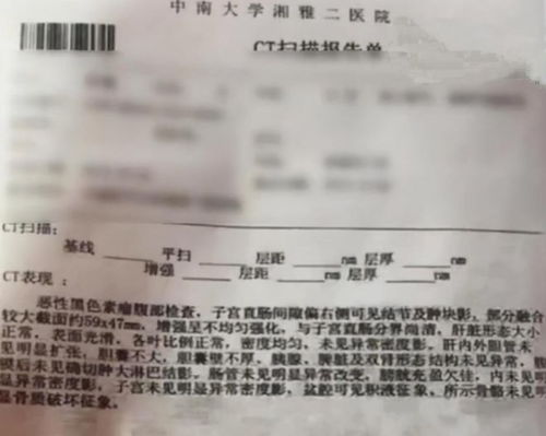 离婚怎么分财产？房子、车子、存款都归谁？一文说清关键点！