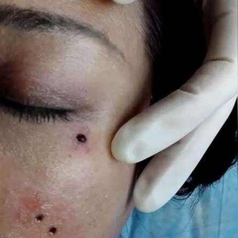 你是不是也这样？