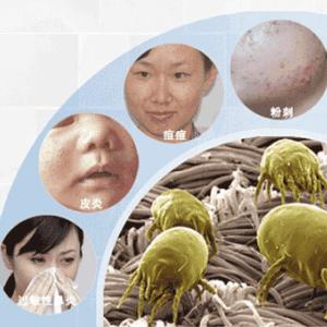 食品包装上没写‘过敏原’孩子吃了进医院—这算谁的责任? 食品包装上没写‘过敏原’孩子吃了进医院—这算谁的责任?