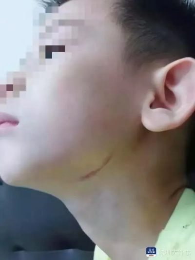 打了一巴掌，警察说不立案？轻微伤到底算不算‘伤’