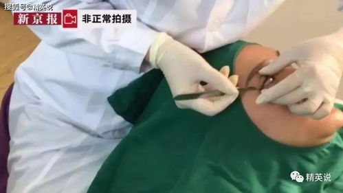 医美到底是美容还是动刀？做完不满意能退钱吗？毁容了谁来担责？